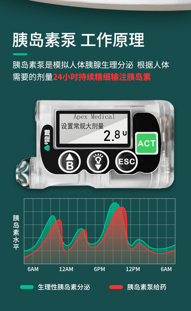 胰岛素泵价格动态更新，市场分析及购买指南